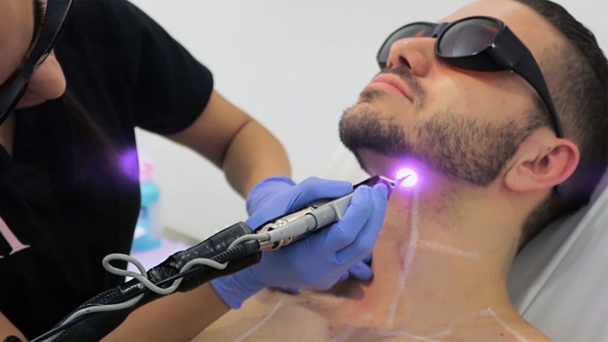 Male Laser Hair Removal: Options and Insights for Dubai Residents