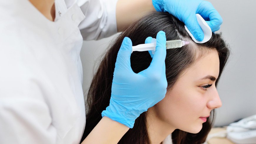 Does Prp Hair Treatment Stop Hair Loss?