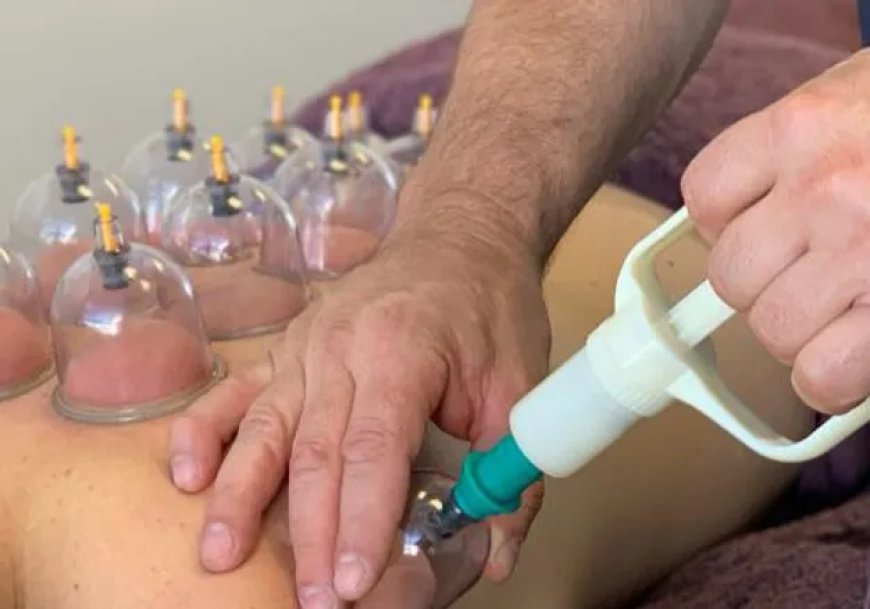 How Hijama Cupping Therapy Enhances Circulation and Vitality?