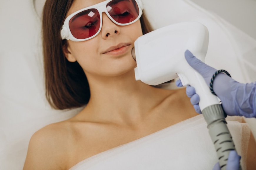 Can you get laser hair removal on the face?