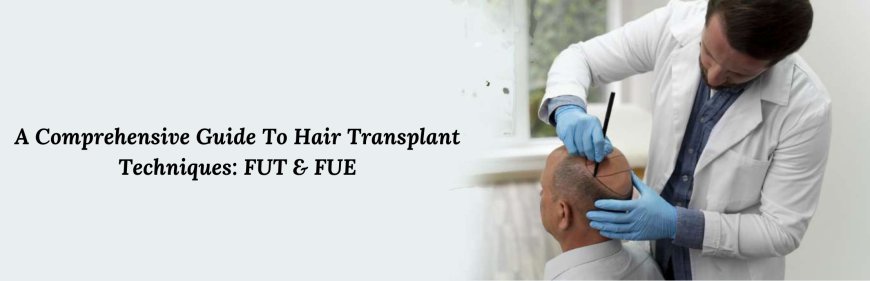 A Comprehensive Guide To Hair Transplant Techniques: FUT & FUE