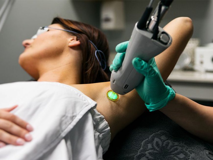 How Does Laser Hair Removal Work for Lasting Results?