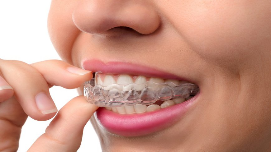 How do I know if my aligners are working ?