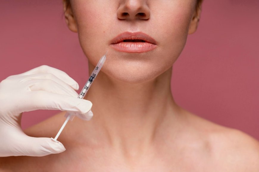 How Safe Are Russian Lip Fillers for Lip Augmentation?