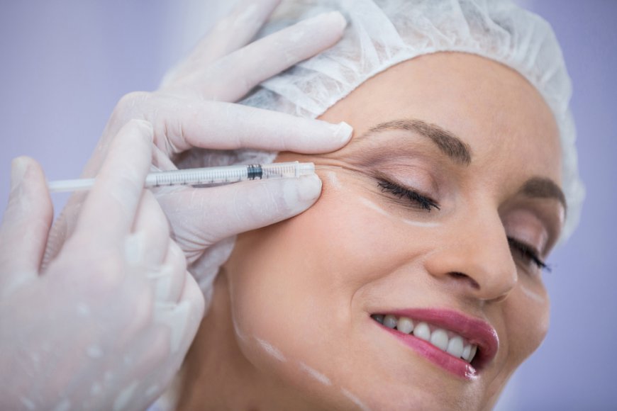 Botox and Acne Scarring: A Surprising Benefit