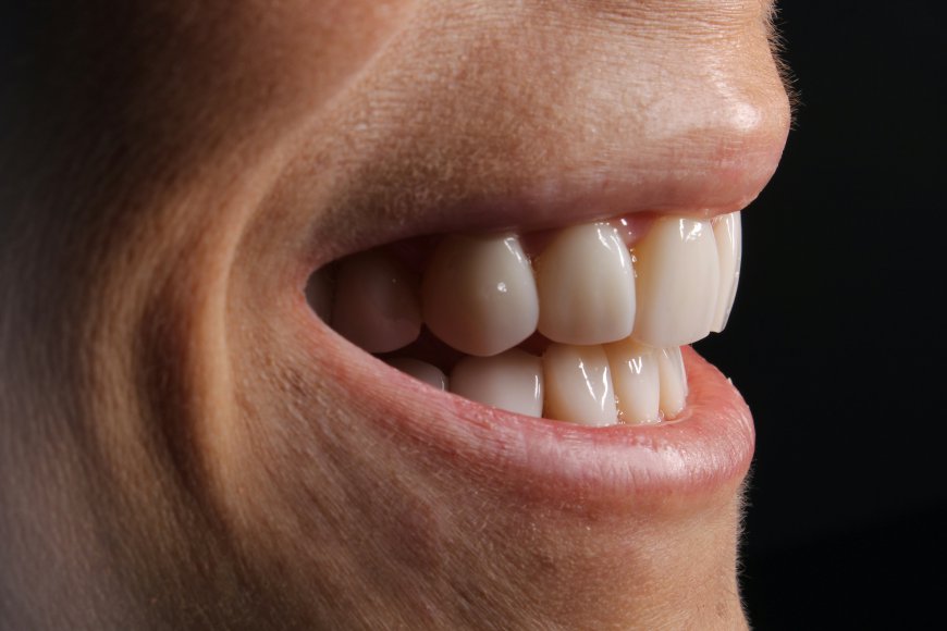 How Cosmetic Dentistry Can Boost Your Confidence and Self-Esteem