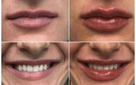 Testosterone Replacement Therapy in Lehigh Valley | Azani