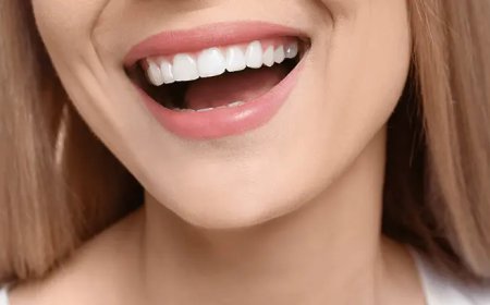 How Does Digital Smile Design Enhance Smile Precision?