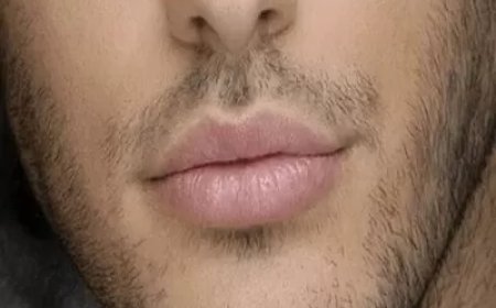 Is Smoker’s Lips Treatment Safe?