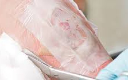 What Are the Different Types of Wounds?