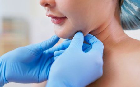 Does Liposuction Work for Double Chin?