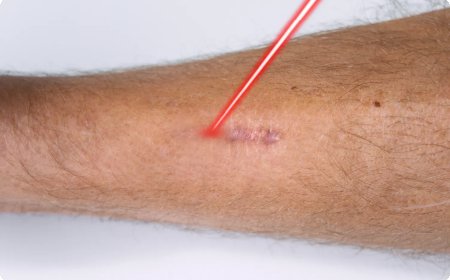 When Is the Right Time to Begin Treatment for Post-Surgical Scars?