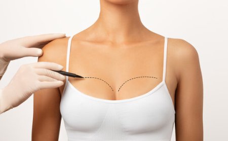 Why Consider Breast Lift Surgery After Weight Loss?