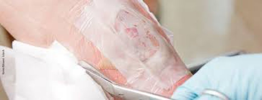 What Are the Different Types of Wounds?