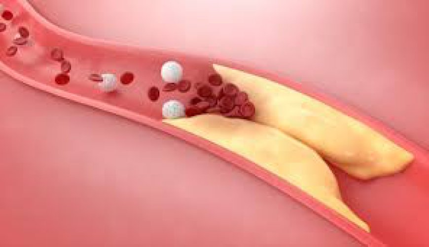 When to See a Specialist for High Cholesterolemia Dubai