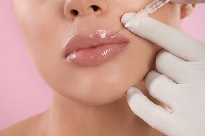 Are Lip Filler Injections a Safe Cosmetic Treatment?