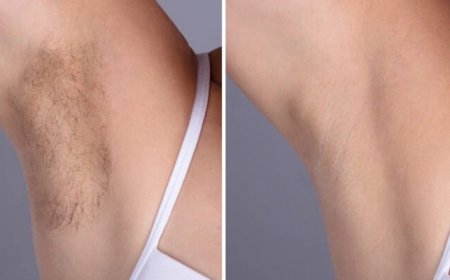 Best Plastic Surgeons in dubai with Customized Laser Hair Removal