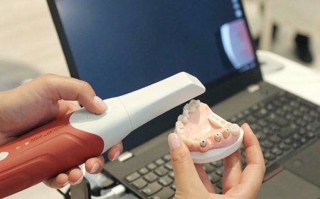 口腔内スキャナー市場規模、トレンド、および成長予測 2026-2033