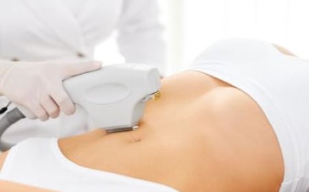 Which Body Areas Can Be Treated with Laser Fat Reduction?