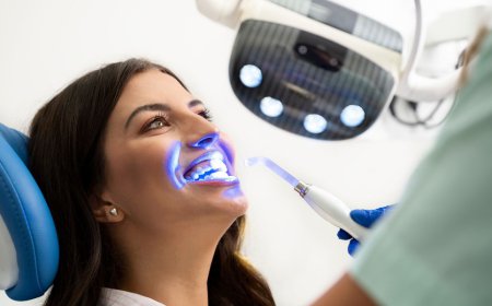 What is Laser Teeth Whitening?