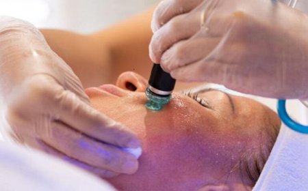 Does Radio Frequency Treatment Help Reduce Acne Scars Effectively?