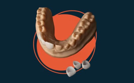 iDD Dental Lab Offers Digital Dental Laboratory Services to Practices Across New Zealand