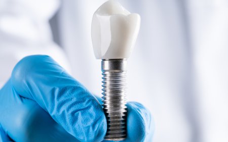 Hutt Dental Implant Centre Brings Specialist Dental Implant Care to Lower Hutt