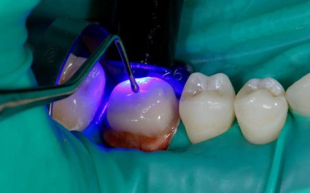 Can Posterior Repair Improve Pelvic Floor Strength?