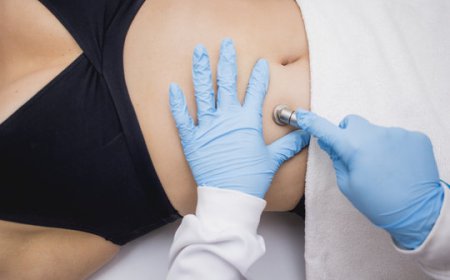 Can Sculptra Fillers Improve Skin Texture and Firmness?