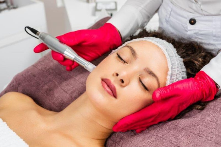 How Many Microneedling Sessions Are Typically Needed for Results?
