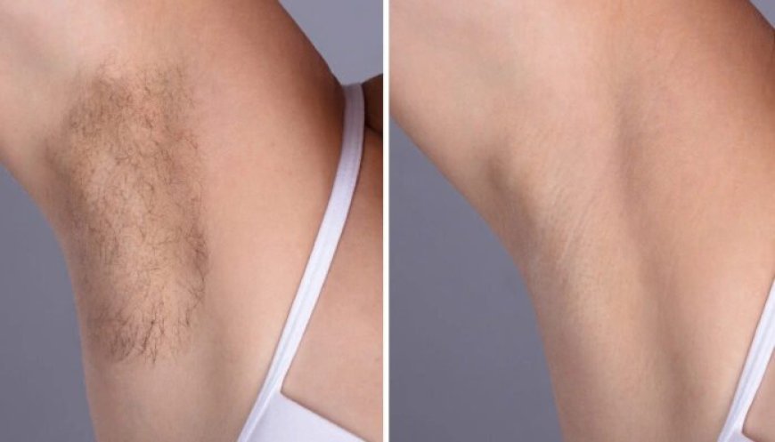 Best Plastic Surgeons in dubai with Customized Laser Hair Removal
