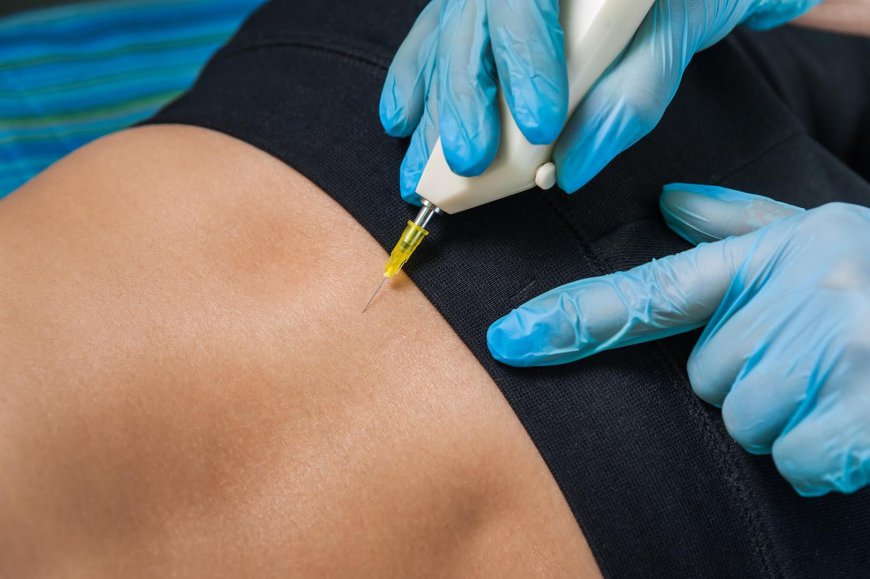 What Conditions Can Ozone Injections Treat?