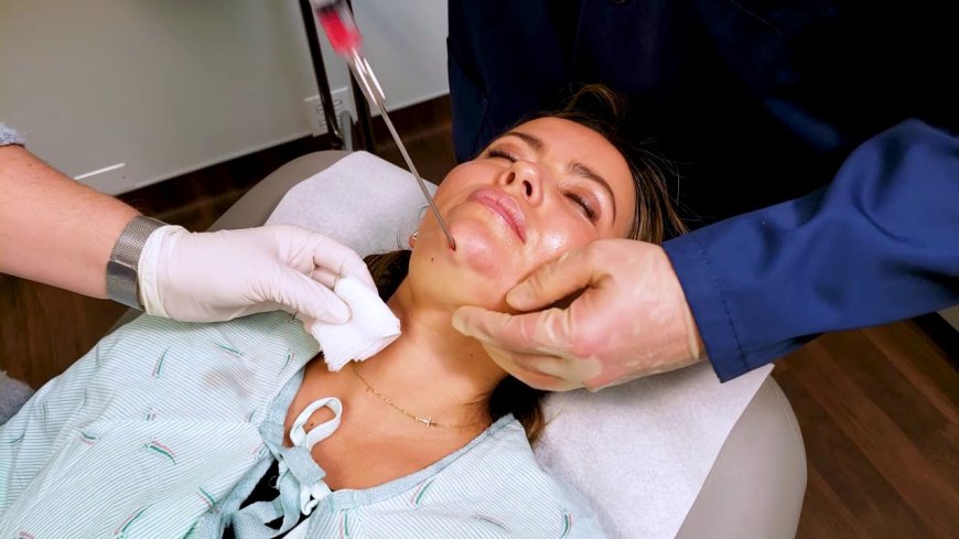 How Double Chin Liposuction Enhances Your Jawline