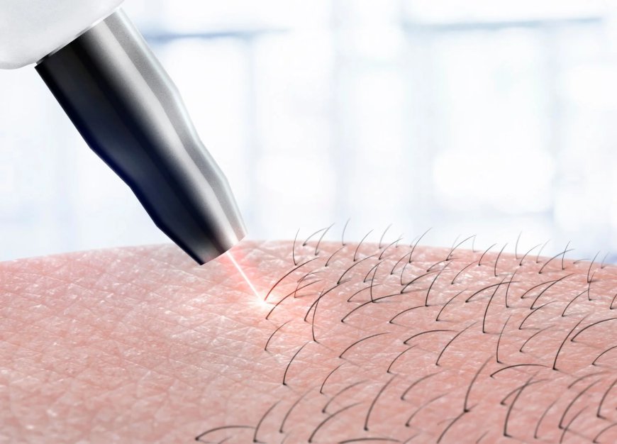 Is Laser Hair Removal Safe for All Skin Types?