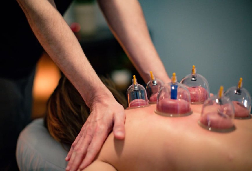 How Hijama Cupping Therapy Enhances Overall Wellness