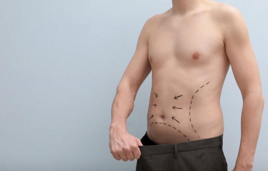 Can GPS Laser Liposuction Treat Double Chin Fat?