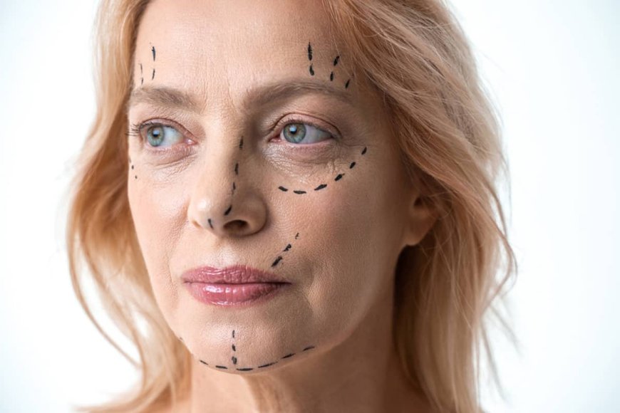 How Does Vector Facelift Compare to Thread Lifts?