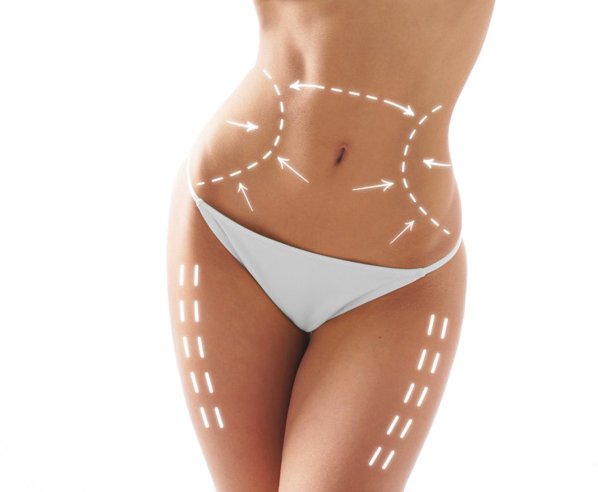 Can Vaser 4D Liposuction Improve Muscle Definition?