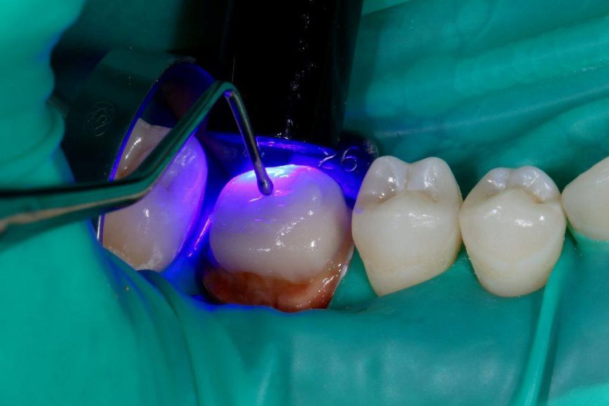 Can Posterior Repair Improve Pelvic Floor Strength?