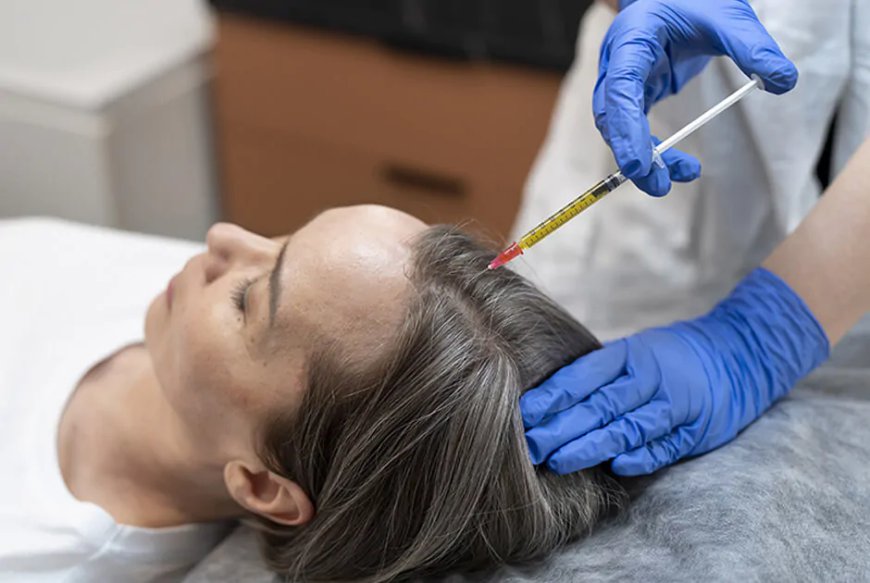 What Is PRP Hair Treatment and How Does It Work?
