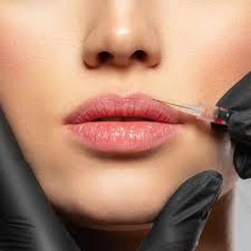 Who Is the Most Suitable Candidate for Lip Fillers?