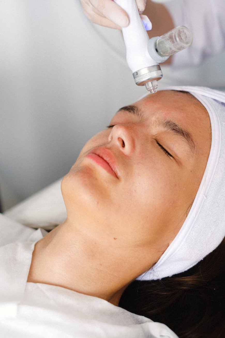 What Are the Key Benefits of Mesotherapy Treatment?