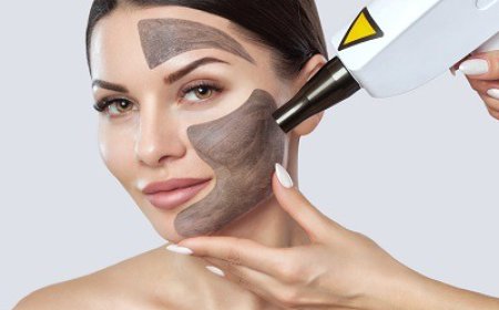 What Is the Average Cost of a Laser Carbon Peel?
