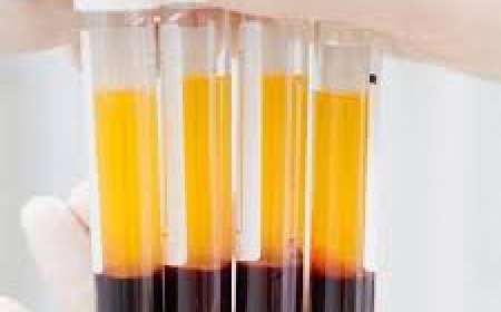 How Does Concentrated Growth Factor Therapy Function?