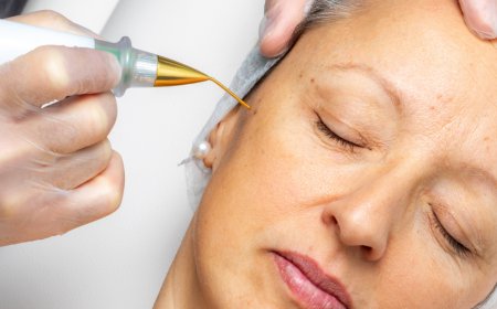 How Does Plasma Pen Treatment Work?