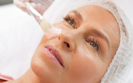 How Does the Cosmelan Peel Work on the Skin?