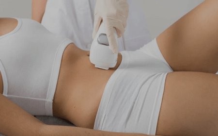 Who is the Best Candidate for Laser Liposuction?