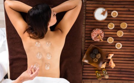Cupping Therapy in Dubai: A Complete Guide to Hijama & Wellness