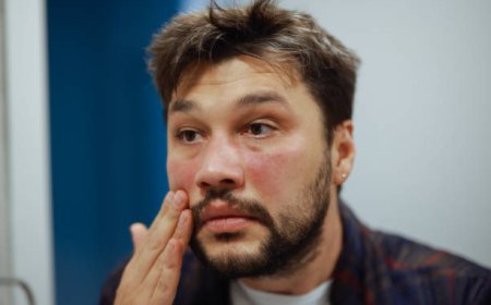 When to Seek Professional Skin Rashes Treatment in Dubai