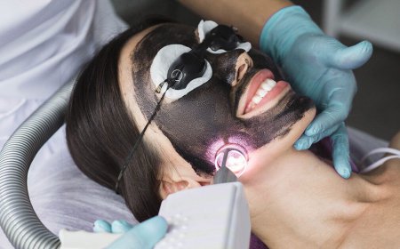 What Is a Spectra Carbon Peel and How Does It Work?
